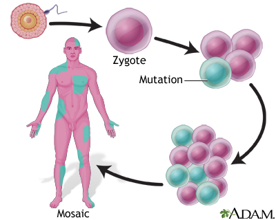 Mosaicism Mosaicism