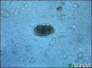 Hookworm egg Hookworm egg