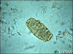 Ascaris lumbricoides egg Ascaris lumbricoides egg
