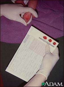 Newborn screening testing Newborn screening testing