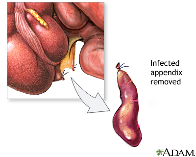 Procedure Procedure
