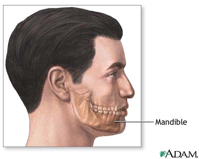 Chin augmentation - series Chin augmentation - series