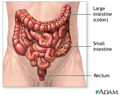 Colostomy - series Colostomy - series