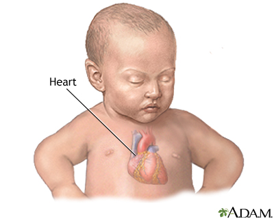 Patent ductus arteriosis (PDA) - series - Infant heart anatomy Patent ductus arteriosis (PDA) - series - Infant heart anatomy