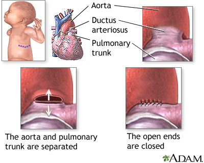 Procedure Procedure