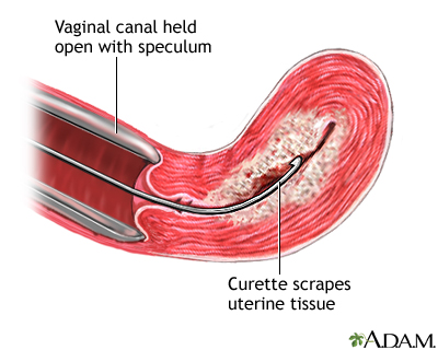 Procedure Procedure