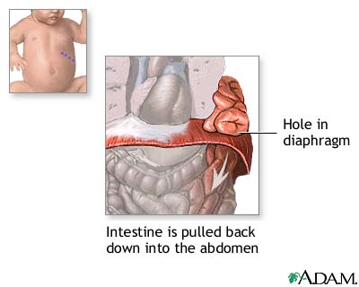 Procedure, part 1 Procedure, part 1