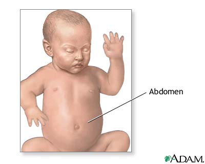 Gastroschisis repair - series