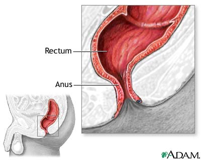 Hemorrhoid surgery - series Hemorrhoid surgery - series