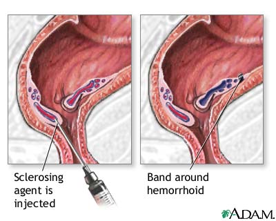 Procedure Procedure