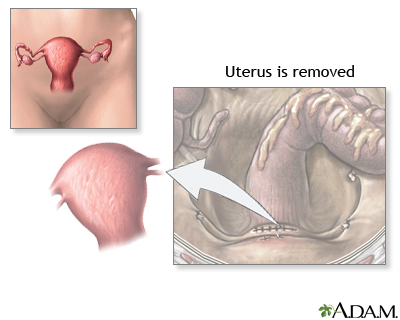 Procedure Procedure