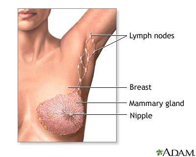 Mastectomy - series - Normal anatomy Mastectomy - series - Normal anatomy