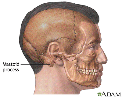 Mastoidectomy - series - Normal anatomy Mastoidectomy - series - Normal anatomy