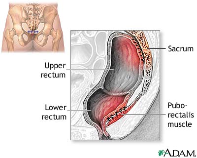 Procedure Procedure