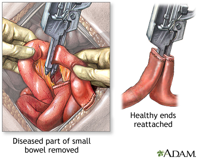 Procedure Procedure