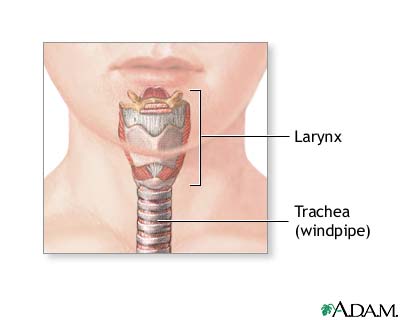 Tracheostomy - series Tracheostomy - series