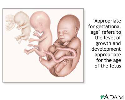 Gestational ages Gestational ages