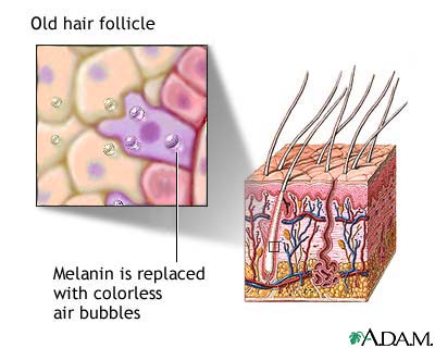 Aged hair follicle Aged hair follicle