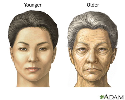 Changes in face with age Changes in face with age