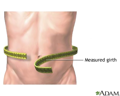 Abdominal girth measurement Abdominal girth measurement