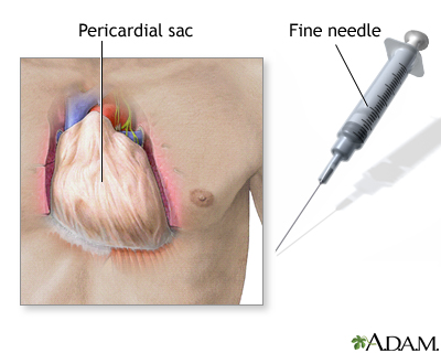 Pericardium Pericardium