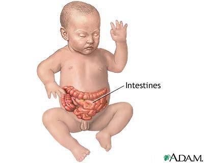 Infant intestines Infant intestines