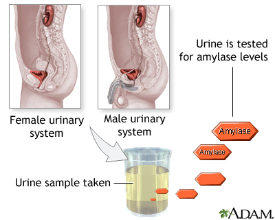 Amylase urine test Amylase urine test
