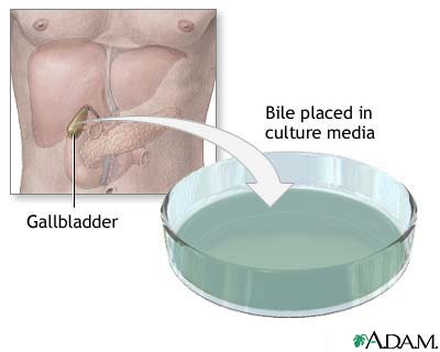 Bile culture Bile culture