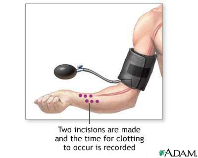 Blood clot test Blood clot test