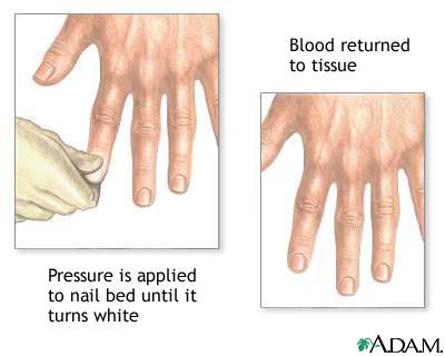 Nail blanch test Nail blanch test