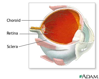 Choroid of the eye Choroid of the eye