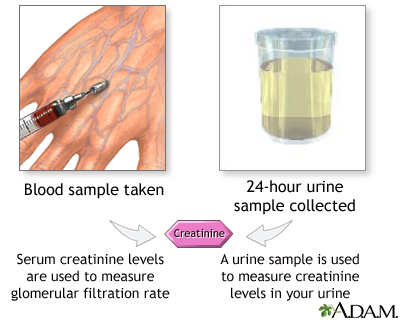 Creatinine tests Creatinine tests