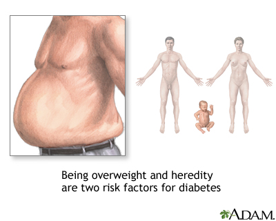 Diabetes risk factors Diabetes risk factors