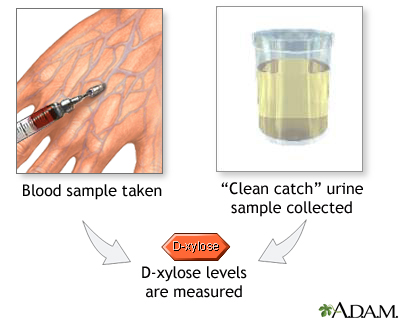 D-xylose level tests D-xylose level tests