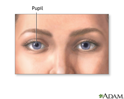 Normal pupil Normal pupil