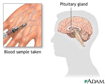 Growth hormone stimulation test Growth hormone stimulation test