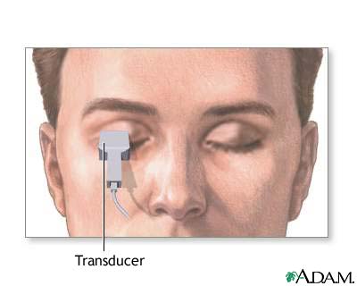 Eye ultrasound Eye ultrasound