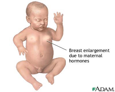 Hormonal effects in newborns Hormonal effects in newborns