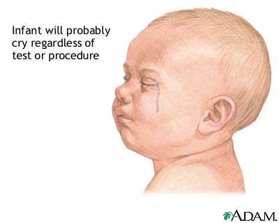 Infant test/procedure preparation Infant test/procedure preparation