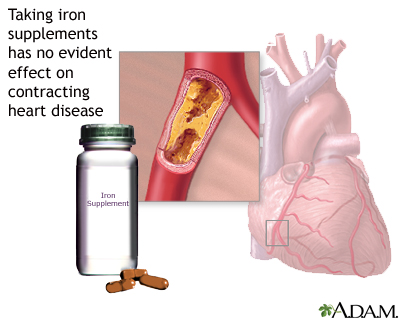 Iron supplements Iron supplements