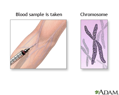 Karyotyping Karyotyping