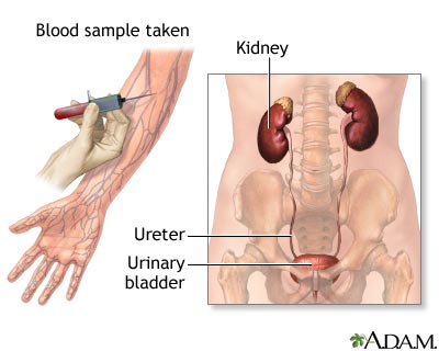 Kidney function tests Kidney function tests