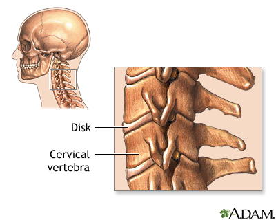 Cervical vertebrae Cervical vertebrae