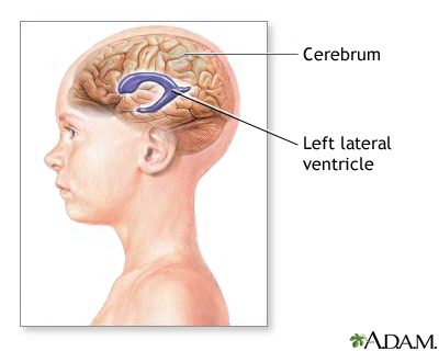 Ventricles of the brain Ventricles of the brain