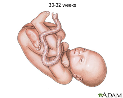 Fetus at 30 to 32 weeks Fetus at 30 to 32 weeks