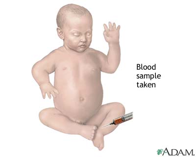 Infant blood sample Infant blood sample