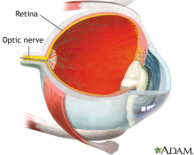 Retina Retina