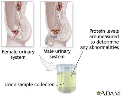 Protein urine test Protein urine test