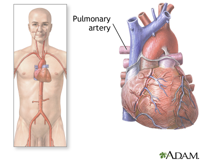 Pulmonary arteries Pulmonary arteries