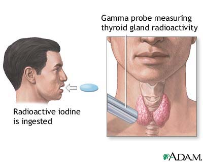 Thyroid uptake test Thyroid uptake test